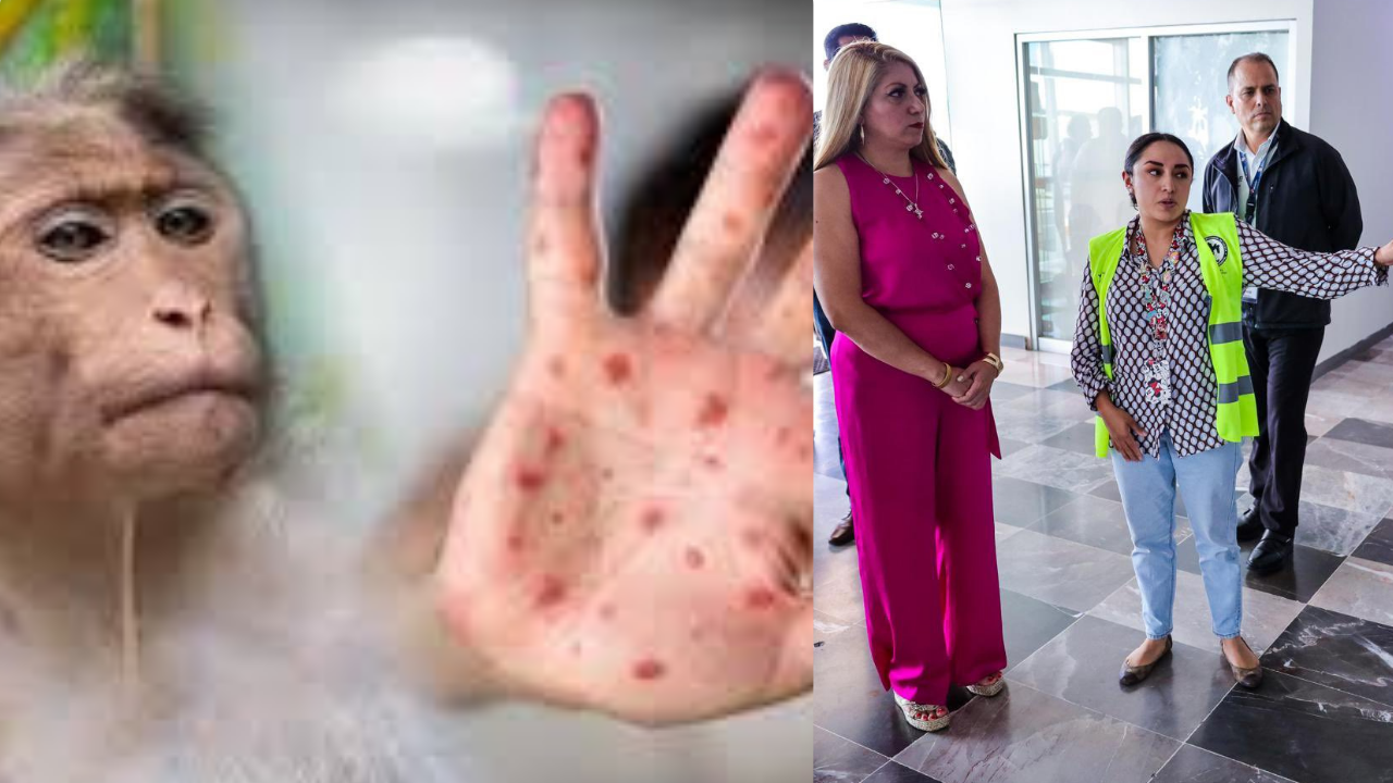 Refuerzan vigilancia en aeropuertos del Edomex ante la viruela del mono