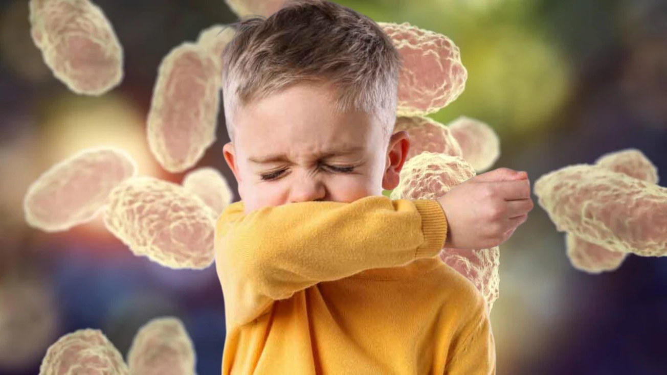 Crecen casos de tos ferina en Edomex: síntomas y cómo prevenir