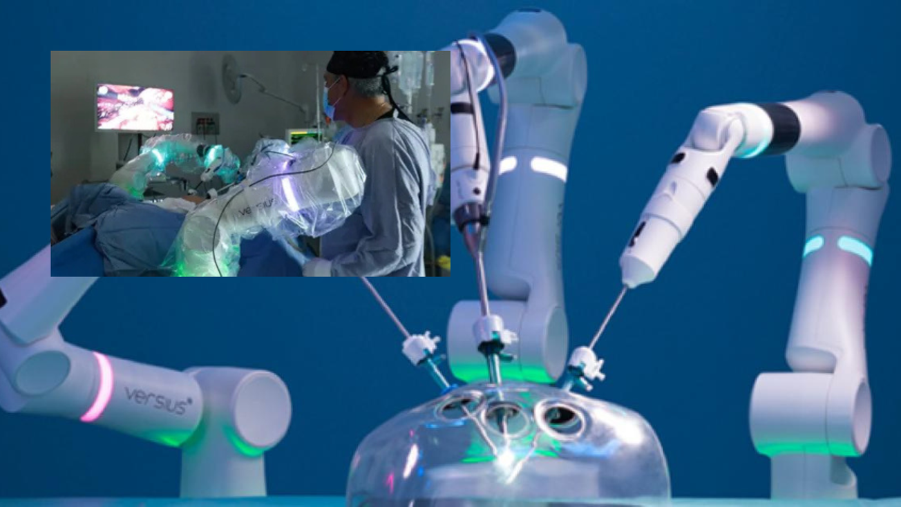 Edomex estrena sistema robótico Versius en hospital público